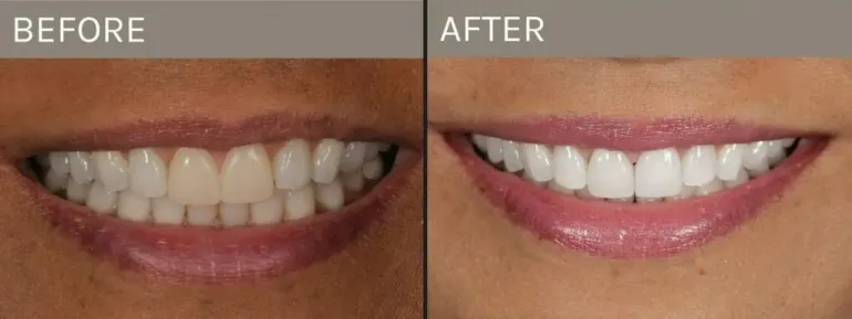 Smile Gallery