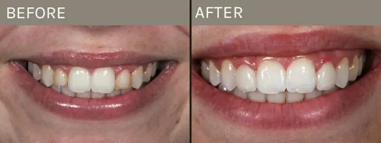 Smile Gallery