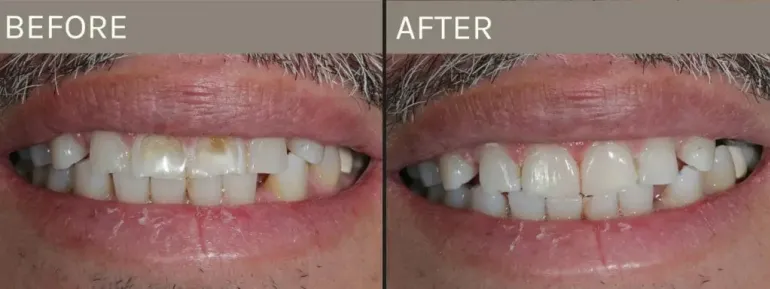 Smile Gallery