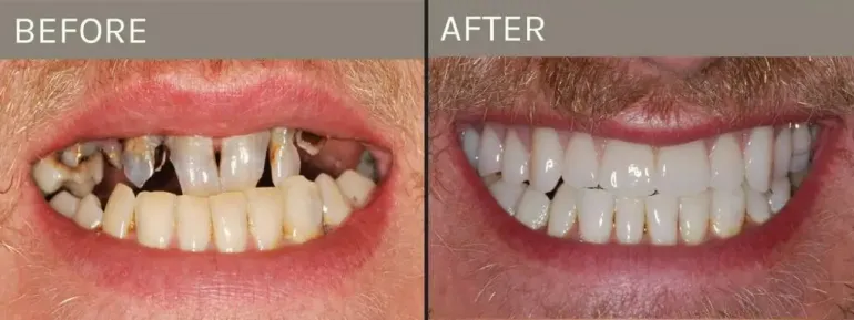 Smile Gallery