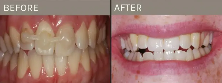 Smile Gallery