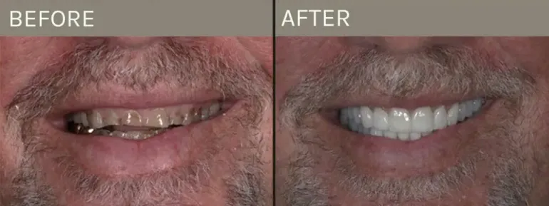 Smile Gallery