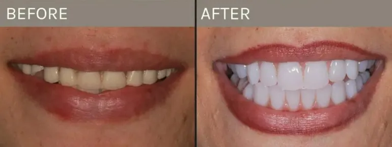Smile Gallery