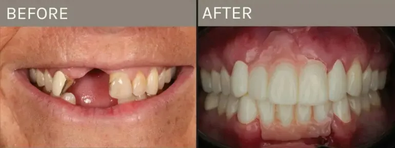 Smile Gallery