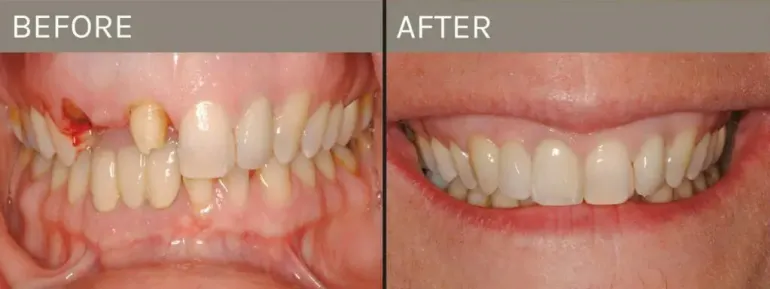 Smile Gallery