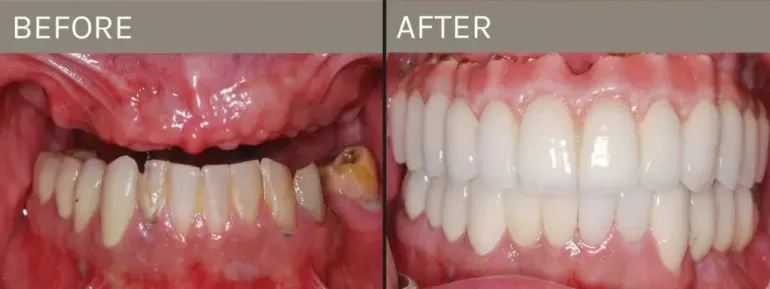 Smile Gallery