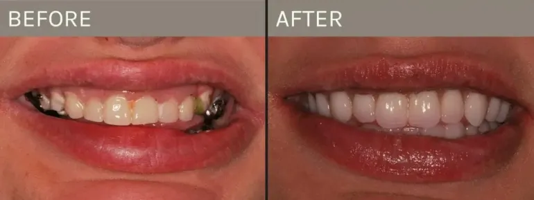 Smile Gallery