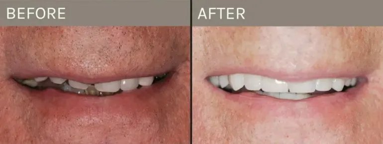 Smile Gallery